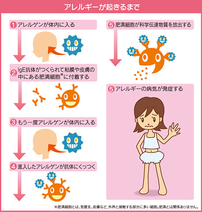 炎 皮膚 アトピー 性 食物アレルギー・アトピー性皮膚炎