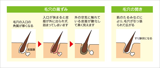 毛穴の開き 黒ずみ 肌の悩み ネイチャー生活倶楽部 ホームページ 公式